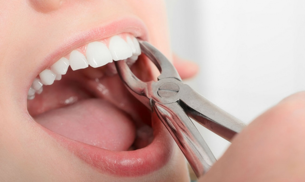 Зубная пластика: виды и применение в современной медицине 