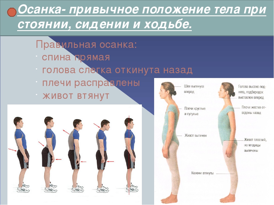 Сколиоз: симптомы, причины, диагностика и лечение