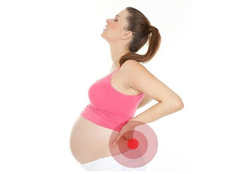 Какие средства от радикулита можно использовать при беременности